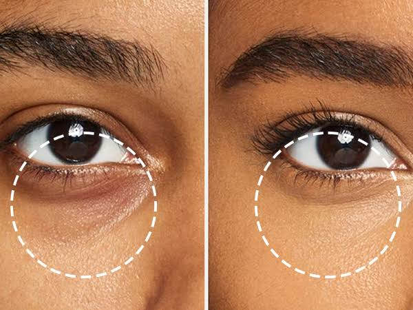 Eye Circles Roller & Refiller